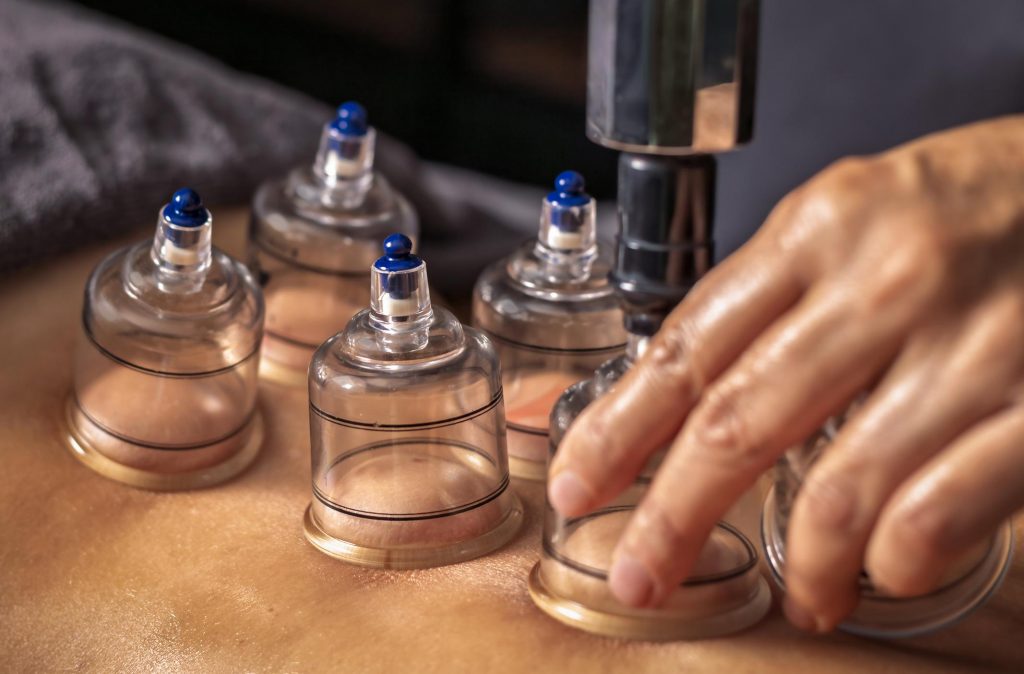 Szakértő válaszol: ezért NE használd a köpölyözést lipödémára